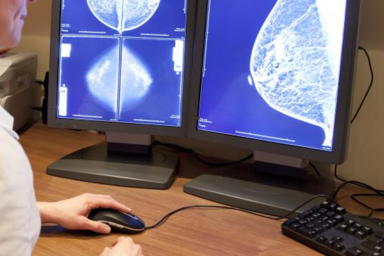 Először Magyarországon vált elérhetővé a régióban a jóindulatú emlődaganat műtét nélküli eltávolítása